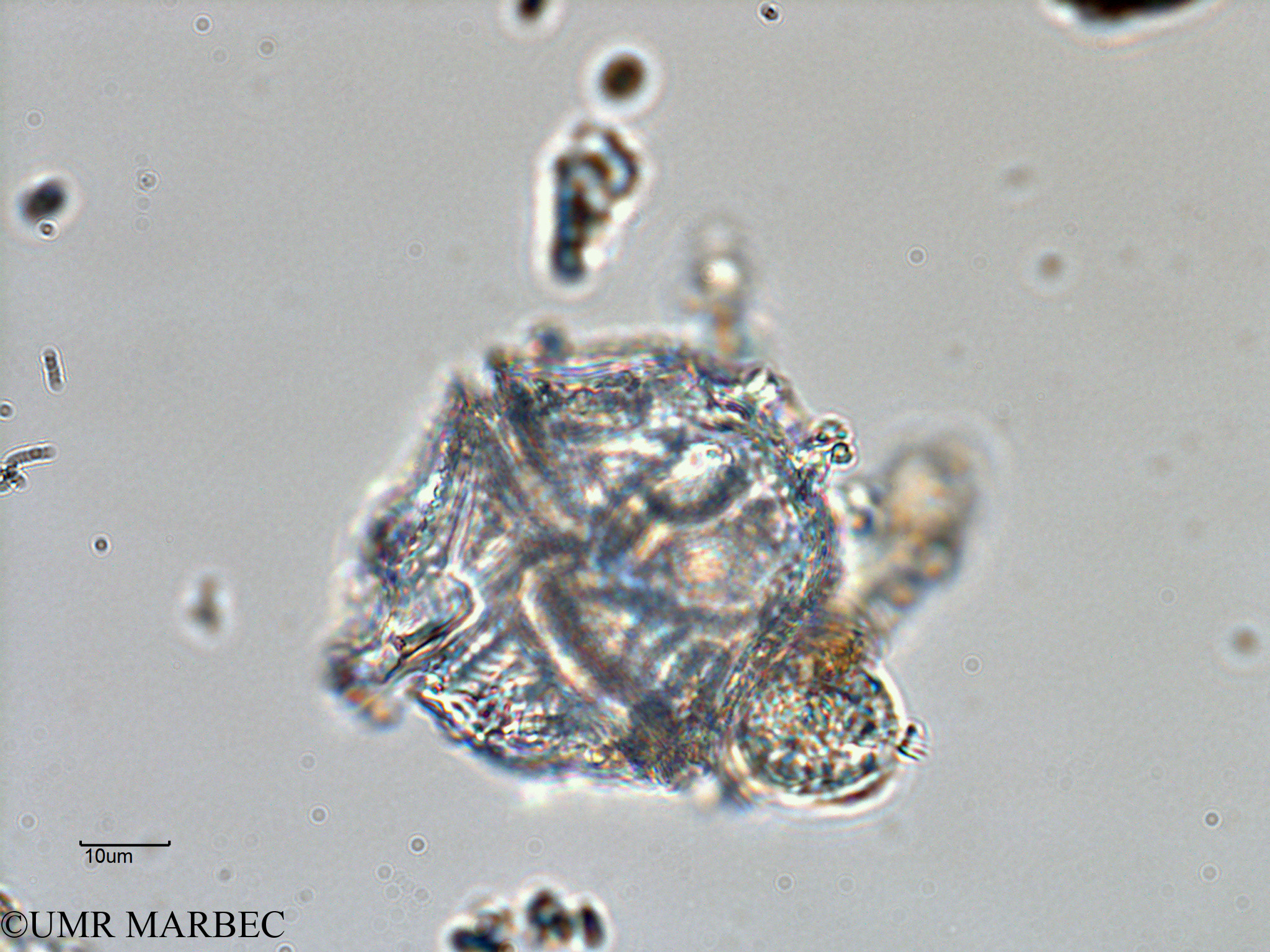 phyto/Bizerte/bizerte_bay/RISCO February 2015/Lingulodinium polyedrum (ancien Gonyaulax spinifera -ancien Baie_T5-ACW2-Gonyaulax-5).tif(copy).jpg